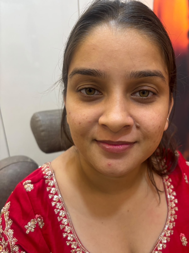 Bridal Transformation Before